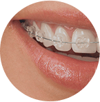 Ортодонтия в стоматологии SiriusDent